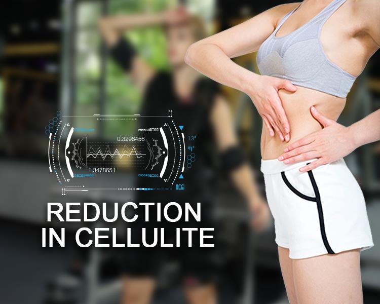 Reduction in cellulite.jpg